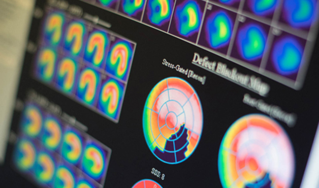 Interner link: Verlinkung zu Nuklearmedizin